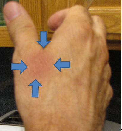 Mesa Tactical Bruse Caused By.png